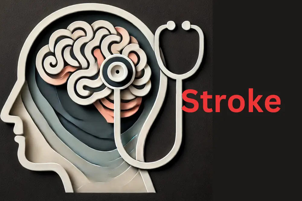 brain-affected-by-stroke