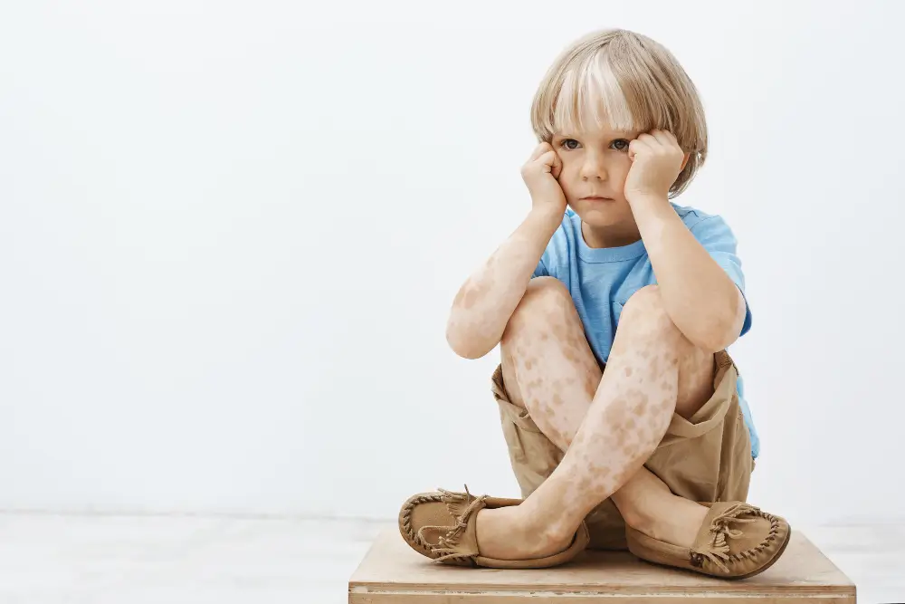 Child-with-Kawasaki-Disease