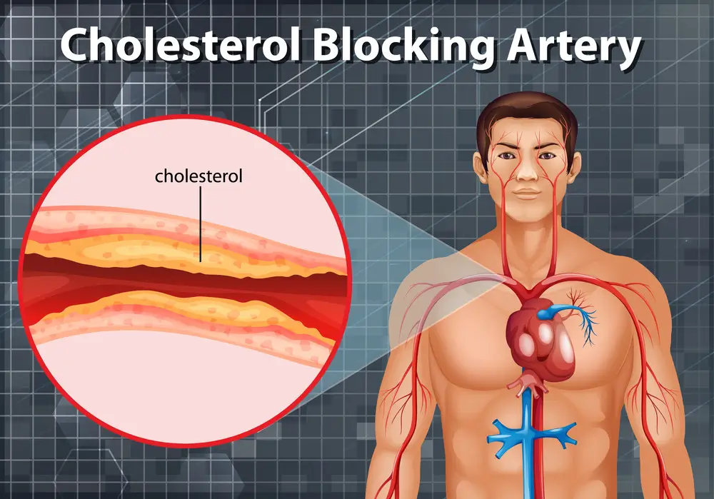 Foods-to-Reduce-Your-Cholesterol-Levels